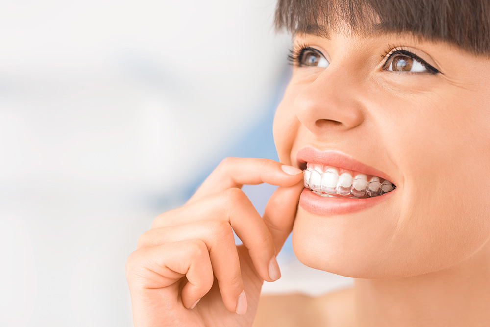 Invisalign vs Braces: Choosing the Right Orthodontic Treatment