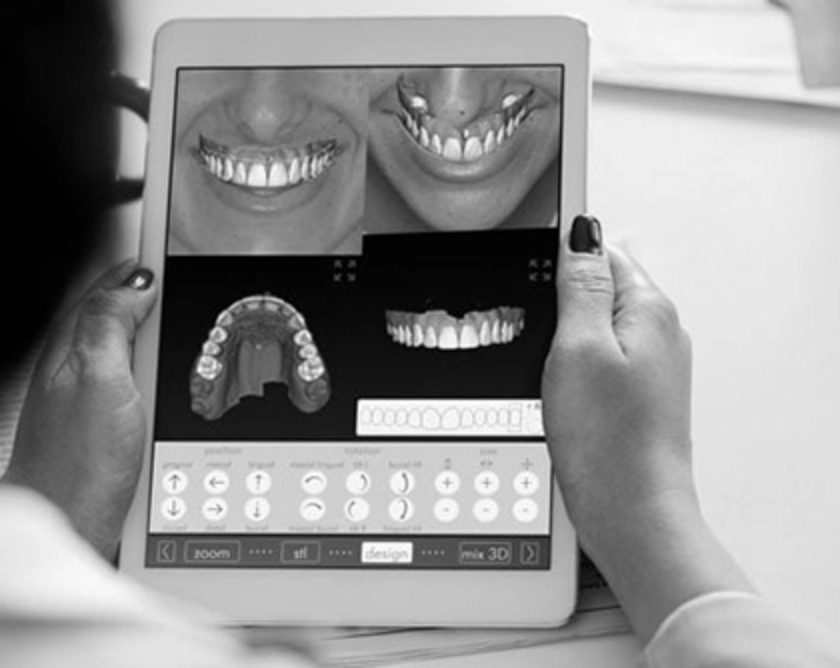 What is Digital Smile Design?