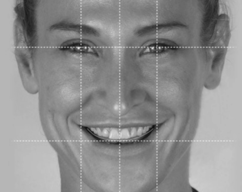 What is Digital Smile Design?